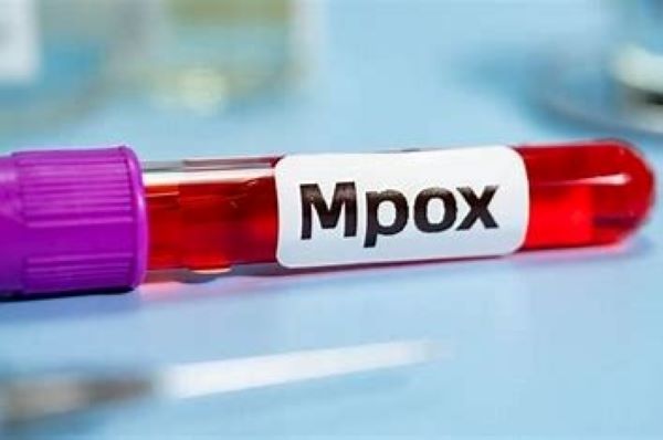 भारत में मिला संदिग्ध Mpox का केस, आइसोलेशन में भेजा गया मरीज